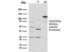 SDS-PAGE Analysis Purified HER-2 Mouse Monoclonal Antibody (ERBB2/3092).