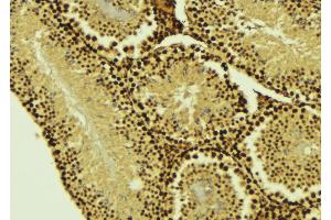ABIN6274505 at 1/100 staining Mouse testis tissue by IHC-P. (XRN2 antibody  (N-Term))