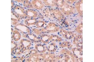 IHC-P analysis of kidney tissue, with DAB staining. (Complement Factor B antibody  (AA 35-160))