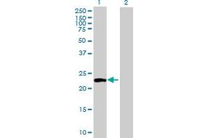 Western Blot analysis of ATG12 expression in transfected 293T cell line by ATG12 MaxPab polyclonal antibody. (ATG12 antibody  (AA 1-187))
