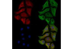 anti-Glutamyl-Prolyl-tRNA Synthetase (EPRS) (pSer999) antibody