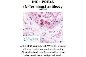 Image no. 1 for anti-phosphodiesterase 3A, cGMP-Inhibited (PDE3A) (N-Term) antibody (ABIN1737914) (PDE3A antibody  (N-Term))
