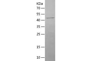 CHRNA1 Protein (AA 21-255) (His-IF2DI Tag)