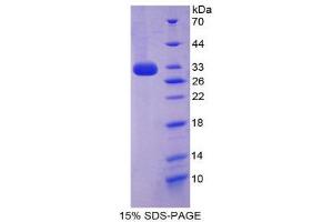 SDS-PAGE (SDS) image for Cytochrome P450, Family 27, Subfamily B, Polypeptide 1 (CYP27B1) (AA 258-504) protein (His tag) (ABIN2124577)