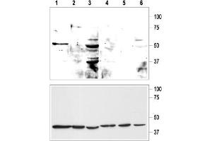 Western blot analysis of KCNK9 in rat cerebellum (lanes 1, 4), human mammary gland MCF-10A (lanes 2, 5) and MCF-7 (lanes 3, 6) cell lysates (upper panel):  - 1-3. (KCNK9 antibody  (Extracellular, P1 Loop))