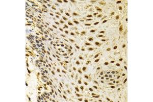 Immunohistochemistry (IHC) image for anti-Polymerase (RNA) II (DNA Directed) Polypeptide C, 33kDa (POLR2C) (AA 1-275) antibody (ABIN3022548)