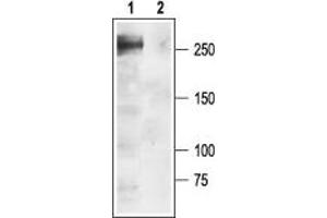 Western blot analysis of rat brain membranes: - 1. (SCN1A antibody  (Intracellular))