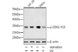 Western blot analysis of extracts of HT-29 and HeLa cells using Phospho-CDK1(Y15) Polyclonal Antibody at dilution of 1:1000.