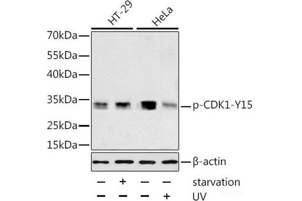 CDK1 anticorps  (pTyr15)