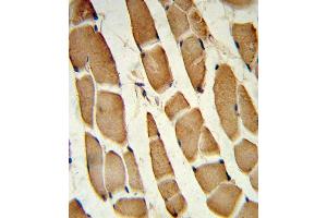 Forlin-fixed and paraffin-embedded hun skeletal muscle reacted with SD4 Antibody (C-term), which was peroxidase-conjugated to the secondary antibody, followed by DAB staining. (SMAD4 antibody  (C-Term))