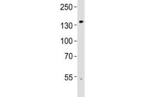Western blot analysis of lysate from human brain tissue using TRPM8 antibody at 1:1000. (TRPM8 antibody  (AA 521-552))