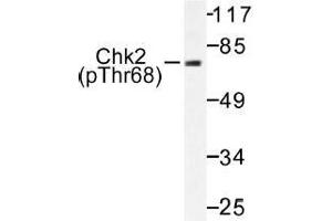 Image no. 1 for anti-Checkpoint Kinase 2 (CHEK2) (pThr68) antibody (ABIN317991) (CHEK2 antibody  (pThr68))
