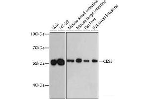Western blot analysis of extracts of various cell lines using CES3 Polyclonal Antibody at dilution of 1:3000. (CES3 antibody)