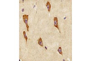 (ABIN6243817 and ABIN6578505) staining GNG12 in human brain tissue sections by Immunohistochemistry (IHC-P - paraformaldehyde-fixed, paraffin-embedded sections). (GNG12 antibody  (AA 37-68))