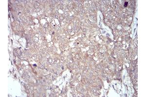 Immunohistochemistry (IHC) image for anti-NADPH Oxidase 4 (NOX4) (AA 210-310) antibody (ABIN5872374) (NADPH Oxidase 4 antibody  (AA 210-310))