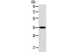 Western Blotting (WB) image for anti-Homeobox D13 (HOXD13) antibody (ABIN5961464) (Homeobox D13 antibody)