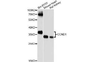Western blot analysis of extracts of various cell lines, using CCND1 antibody (ABIN5970620) at 1/500 dilution. (Cyclin D1 antibody)