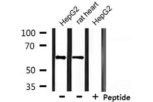 Western blot analysis of extracts from HepG2 and rat heart, using CLCC1 Antibody.