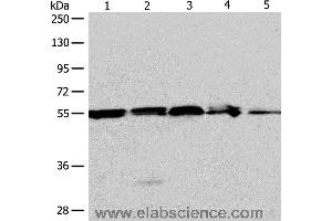 Western blot analysis of A375, 293T cell and mouse liver tissue, Jurkat cell and human fetal kidney tissue, using NAMPT Polyclonal Antibody at dilution of 1:700