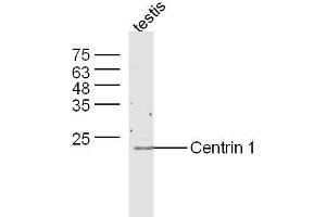 Mouse testis lysates probed with Anti-Centrin 1 Polyclonal Antibody, Unconjugated  at 1:300 overnight at 4˚C. (Centrin 1 antibody  (AA 21-120))