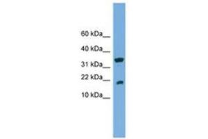 Image no. 1 for anti-Acid Phosphatase 1, Soluble (ACP1) (AA 35-84) antibody (ABIN6744721)