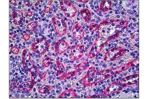 Immunohistochemistry (Paraffin-embedded Sections) (IHC (p)) image for anti-Nitric Oxide Synthase 3 (Endothelial Cell) (NOS3) (AA 1181-1194) antibody (ABIN784232)
