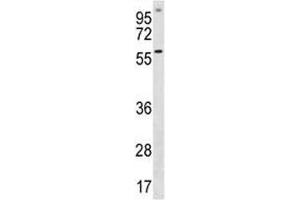 ETV5 antibody western blot analysis in A549 lysate (ETV5 antibody  (AA 8-37))