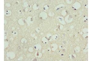 Immunohistochemistry of paraffin-embedded human brain tissue using ABIN7163991 at dilution of 1:100 (KCNH1 antibody  (AA 840-989))