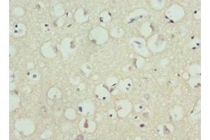 Immunohistochemistry of paraffin-embedded human brain tissue using ABIN7163991 at dilution of 1:100