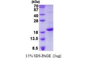 Figure annotation denotes ug of protein loaded and % gel used. (CD83 Protein (CD83))