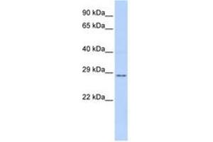 Image no. 1 for anti-Tissue Factor Pathway Inhibitor 2 (TFPI2) (AA 72-121) antibody (ABIN6741435) (TFPI2 antibody  (AA 72-121))