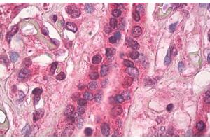 Human Placenta: Formalin-Fixed, Paraffin-Embedded (FFPE) (TGM1 antibody)