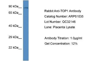 Western Blotting (WB) image for anti-Topoisomerase (DNA) I (TOP1) (N-Term) antibody (ABIN2788658)