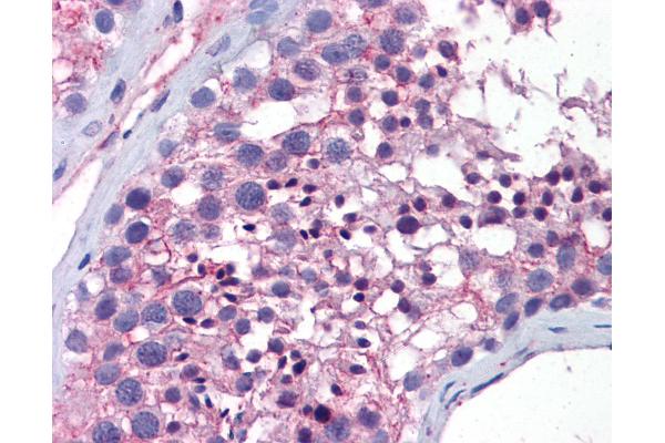 WNT10A antibody  (AA 101-150)