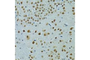Immunohistochemistry of paraffin-embedded mouse brain using MUS81 antibody (ABIN6132372, ABIN6144202, ABIN6144203 and ABIN6222560) at dilution of 1:100 (40x lens). (MUS81 antibody  (AA 1-350))