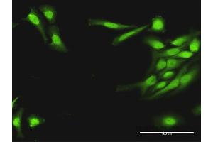 Immunofluorescence of purified MaxPab antibody to PLA2G16 on HeLa cell. (PLA2G16 antibody  (AA 1-162))