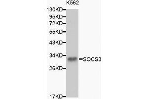 Western blot analysis of K562 cell lysate using SOCS3 antibody.