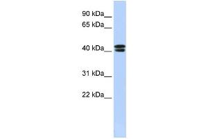 Western Blotting (WB) image for anti-Calcium Channel, Voltage-Dependent, beta 3 Subunit (CACNB3) antibody (ABIN2458122) (CACNB3 antibody)