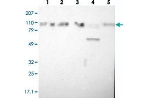 Western blot analysis of Lane 1: RT-4, Lane 2: EFO-21, Lane 3: A-431, Lane 4: Liver, Lane 5: Tonsil with SMEK2 polyclonal antibody  at 1:250-1:500 dilution.