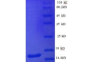SDS-PAGE (SDS) image for Interleukin 4 (IL4) (AA 25-132) protein (His tag) (ABIN5709749)