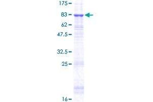 TINAG Protein (AA 1-476) (GST tag)