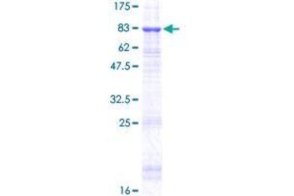 TINAG Protein (AA 1-476) (GST tag)