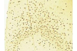 ABIN6269019 at 1/100 staining Mouse brain tissue by IHC-P. (HDAC7 antibody  (C-Term))