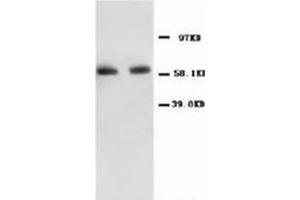 Western blot with NFκBP65 Polyclonal Antibody (NF-kB p65 antibody  (N-Term))