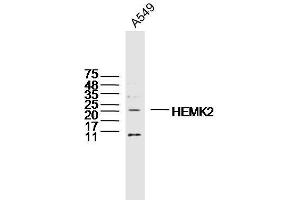 A549 lysates probed with HEMK2 Polyclonal Antibody, Unconjugated  at 1:300 dilution and 4˚C overnight incubation. (N6AMT1 antibody  (AA 1-100))