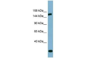 WB Suggested Anti-EPRS Antibody Titration:  0. (EPRS antibody  (Middle Region))