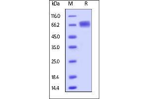 Human LILRB3, His Tag on  under reducing (R) condition. (LILRB3 Protein (AA 24-443) (His tag))