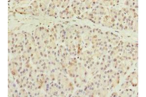 Immunohistochemistry of paraffin-embedded human pancreatic tissue using ABIN7148076 at dilution of 1:100 (CCDC116 antibody  (AA 1-300))