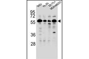 FOXC2 Antibody (Center ) (ABIN655526 and ABIN2845039) western blot analysis in WiDr,HL-60,ZR-75-1,MDA-M cell line lysates (35 μg/lane).