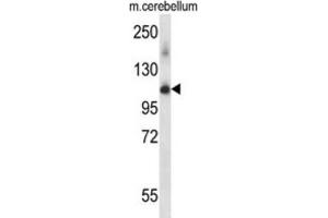Western Blotting (WB) image for anti-Serine/threonine-Protein Kinase PRP4 Homolog (PRPF4B) antibody (ABIN2997999) (PRPF4B antibody)